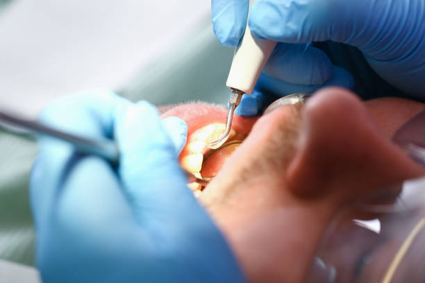 Best Emergency Dental Surgery in Phoenix, IL