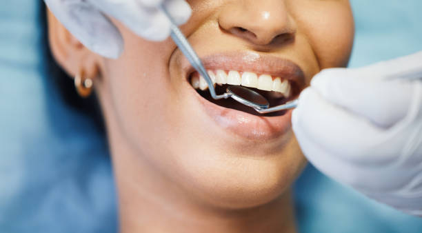 Best Emergency Tooth Extraction in Phoenix, IL