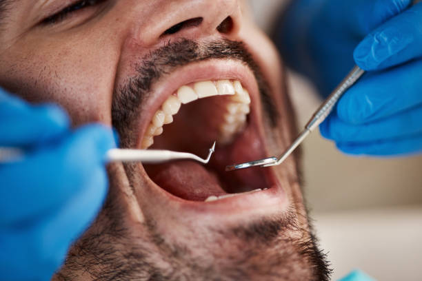 Best Pediatric Emergency Dentist in Phoenix, IL